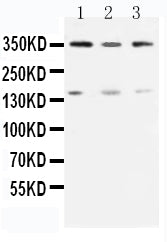 Anti-Serine-protein kinase ATM ATM Antibody Picoband® Boster Bio