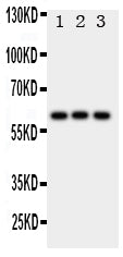 Anti-HEXA Antibody Picoband® Boster Bio