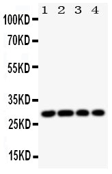 Anti-HLA DMB/HLA-DMB Antibody Picoband® Boster Bio