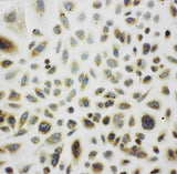 Anti-Cpn10/HSPE1 Antibody Picoband® Boster Bio