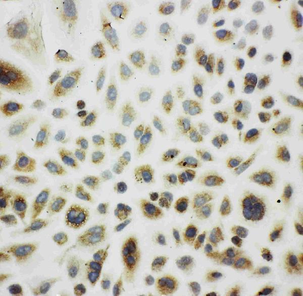 Anti-Cpn10/HSPE1 Antibody Picoband® Boster Bio
