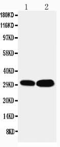 Anti-LIM and SH3 domain protein 1 LASP1 Antibody Picoband® Boster Bio