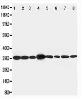 Anti-LIM and SH3 domain protein 1 LASP1 Antibody Picoband® Boster Bio