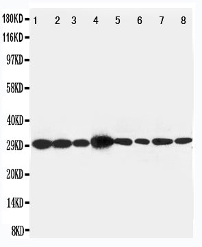 Anti-LIM and SH3 domain protein 1 LASP1 Antibody Picoband® Boster Bio