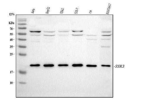 Anti-SSR3 Antibody Picoband® Boster Bio
