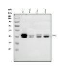 Anti-Polycomb complex protein BMI-1 Bmi1 Antibody Picoband® Boster Bio