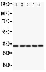 Anti-Transcription factor E2F6 E2F6 Antibody Picoband® Boster Bio
