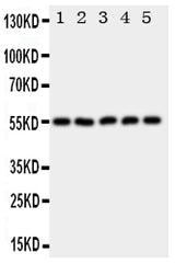 Anti-Hyaluronidase-2 HYAL2 Antibody Picoband® Boster Bio