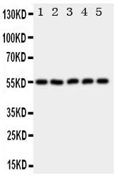 Anti-Hyaluronidase-2 HYAL2 Antibody Picoband® Boster Bio