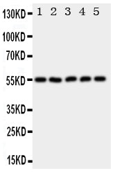 Anti-Hyaluronidase-2 HYAL2 Antibody Picoband® Boster Bio
