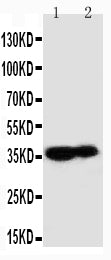 Anti-Kallikrein 9/KLK9 Antibody Picoband® Boster Bio