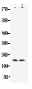 Anti-Myoglobin/MB Antibody Picoband® Boster Bio