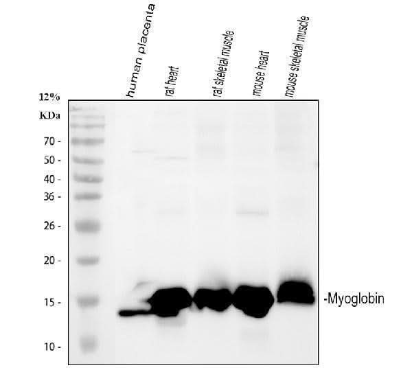 Anti-Myoglobin/MB Antibody Picoband® Boster Bio