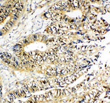 Anti-NME2 Antibody Picoband® Boster Bio