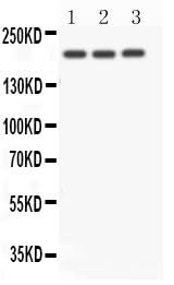 Anti-NOTCH4 Antibody Picoband® Boster Bio