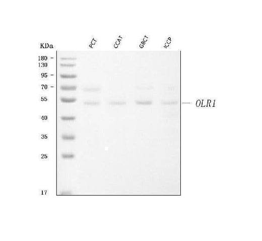 Anti-LOX 1/OLR1 Antibody Picoband® Boster Bio
