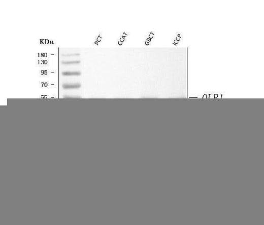 Anti-LOX 1/OLR1 Antibody Picoband® Boster Bio
