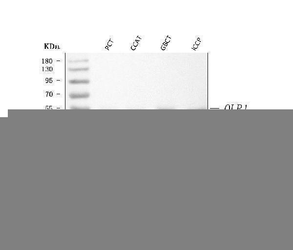 Anti-LOX 1/OLR1 Antibody Picoband® Boster Bio