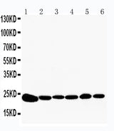 Anti-Peroxiredoxin 2/PRDX2 Antibody Picoband® Boster Bio