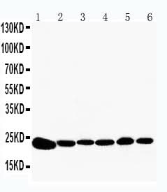 Anti-Peroxiredoxin 2/PRDX2 Antibody Picoband® Boster Bio