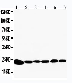 Anti-Peroxiredoxin 2/PRDX2 Antibody Picoband® Boster Bio