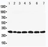 Anti-Peroxiredoxin 4/PRDX4 Antibody Picoband® Boster Bio