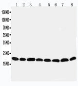 Anti-Peroxiredoxin 5/PRDX5 Antibody Picoband® Boster Bio