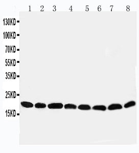 Anti-Peroxiredoxin 5/PRDX5 Antibody Picoband® Boster Bio