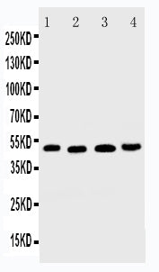 Anti-DR5/TNFRSF10B Antibody Picoband® Boster Bio