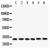 Anti-Caspase 3/CASP3 Antibody Picoband® Boster Bio