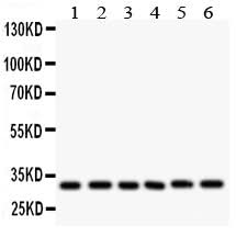 Anti-Caspase 3/CASP3 Antibody Picoband® Boster Bio