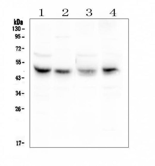Anti-Coxsackie Adenovirus Receptor/CXADR Antibody Picoband® Boster Bio