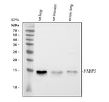 Anti-Fatty Acid Binding Protein 5/FABP5 Antibody Picoband® Boster Bio