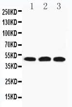 Anti-Hyaluronidase-3 HYAL3 Antibody Picoband® Boster Bio