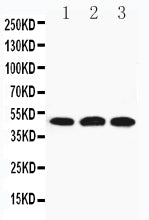 Anti-Hyaluronidase-3 HYAL3 Antibody Picoband® Boster Bio
