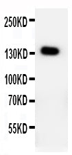 Anti-PTCH2 Antibody Picoband® Boster Bio