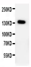 Anti-PTCH2 Antibody Picoband® Boster Bio