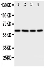 Anti-RIP2/RIPK2 Antibody Picoband® Boster Bio