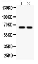Anti-TGF beta Receptor II/TGFBR2 Antibody Picoband® Boster Bio