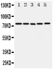 Anti-ABCG1 Antibody Picoband® Boster Bio
