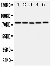 Anti-ABCG1 Antibody Picoband® Boster Bio