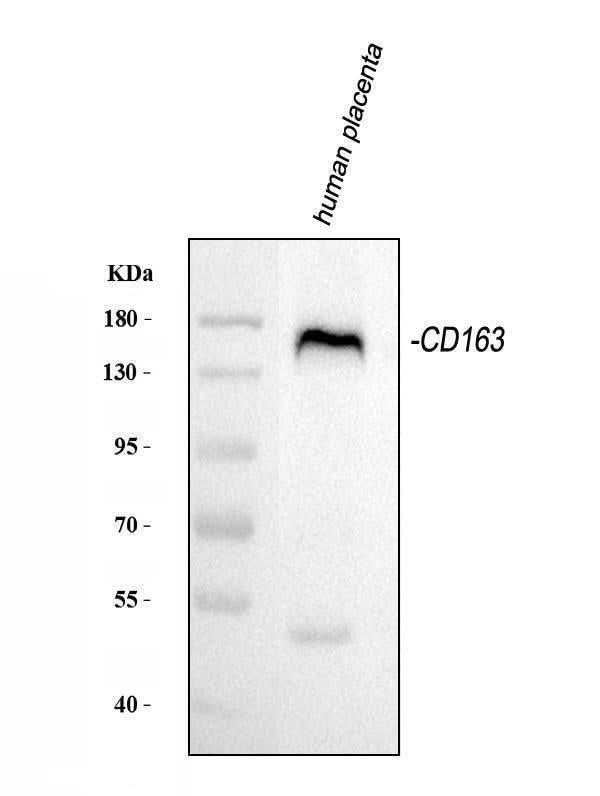 Anti-CD163 Antibody Picoband® Boster Bio