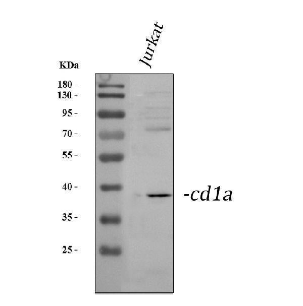 Anti-CD1a Antibody Picoband® Boster Bio