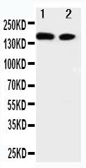 Anti-ErbB 4/ERBB4 Antibody Picoband® Boster Bio