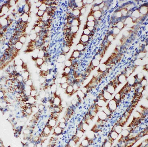 Anti-Tyrosine-protein kinase Fer FER Antibody Picoband® Boster Bio