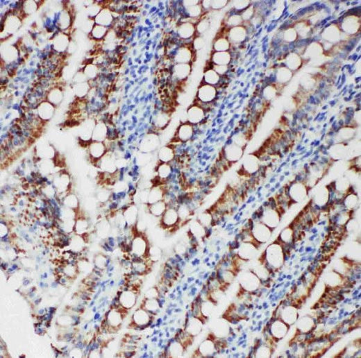 Anti-Tyrosine-protein kinase Fer FER Antibody Picoband® Boster Bio