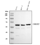 Anti-Smad2 Antibody Picoband® Boster Bio
