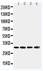 Anti-Superoxide Dismutase 3/SOD3 Antibody Picoband® Boster Bio