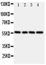 Anti-TXNRD2 Antibody Picoband® Boster Bio