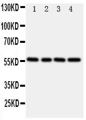 Anti-TXNRD2 Antibody Picoband® Boster Bio